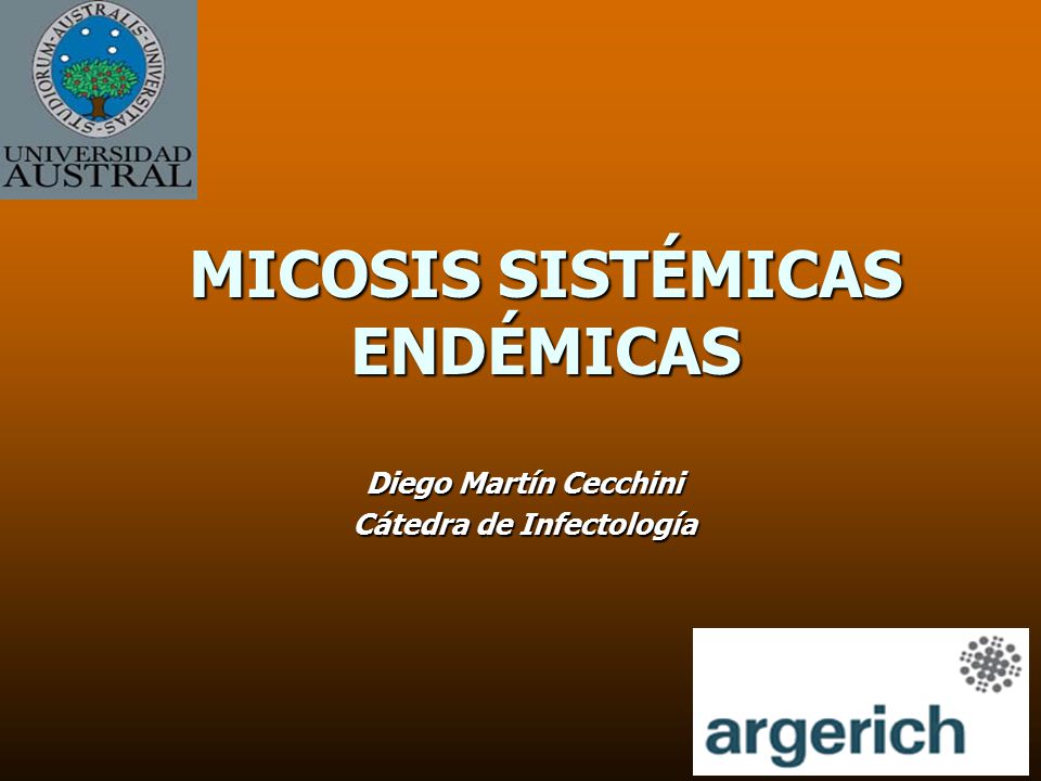que es una infeccion micotica sistemica